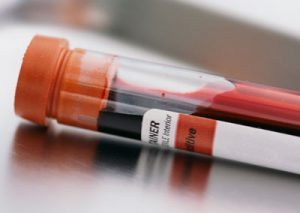 Blood sample