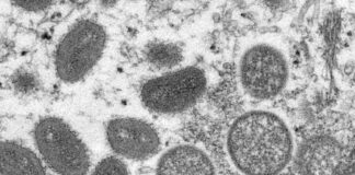 Monkeypox