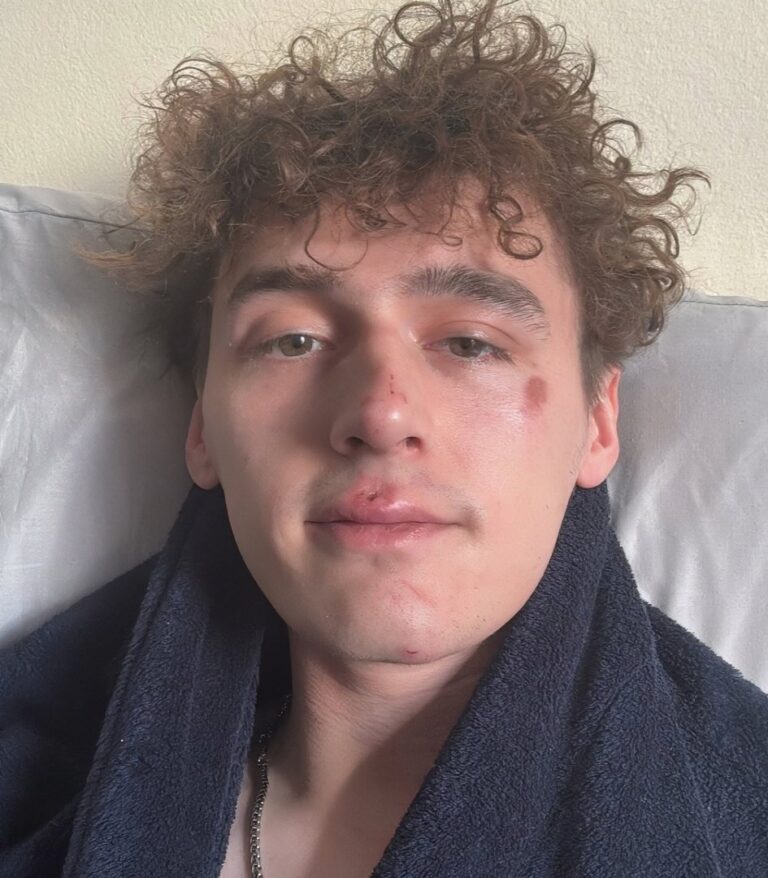 Reality Star Cameron Cole Speaks Out After Homophobic Birthday Attack ...